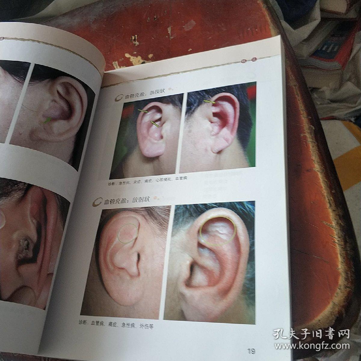 耳穴诊断彩色图鉴_黄丽春 著_孔夫子旧书网