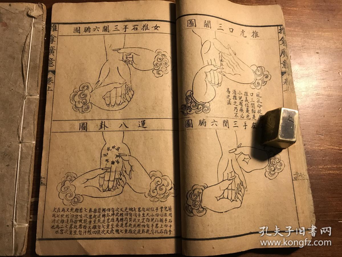 推拿中医药古医书:清末精印《小儿推拿广意》上中下三