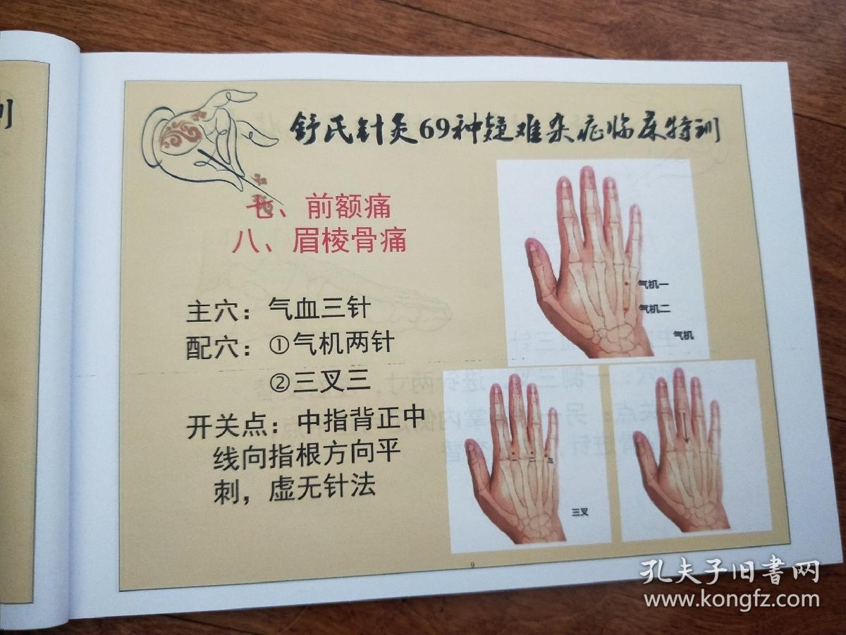 实拍图《新品舒氏针灸69种杂证内部资料》全彩78页实体包邮