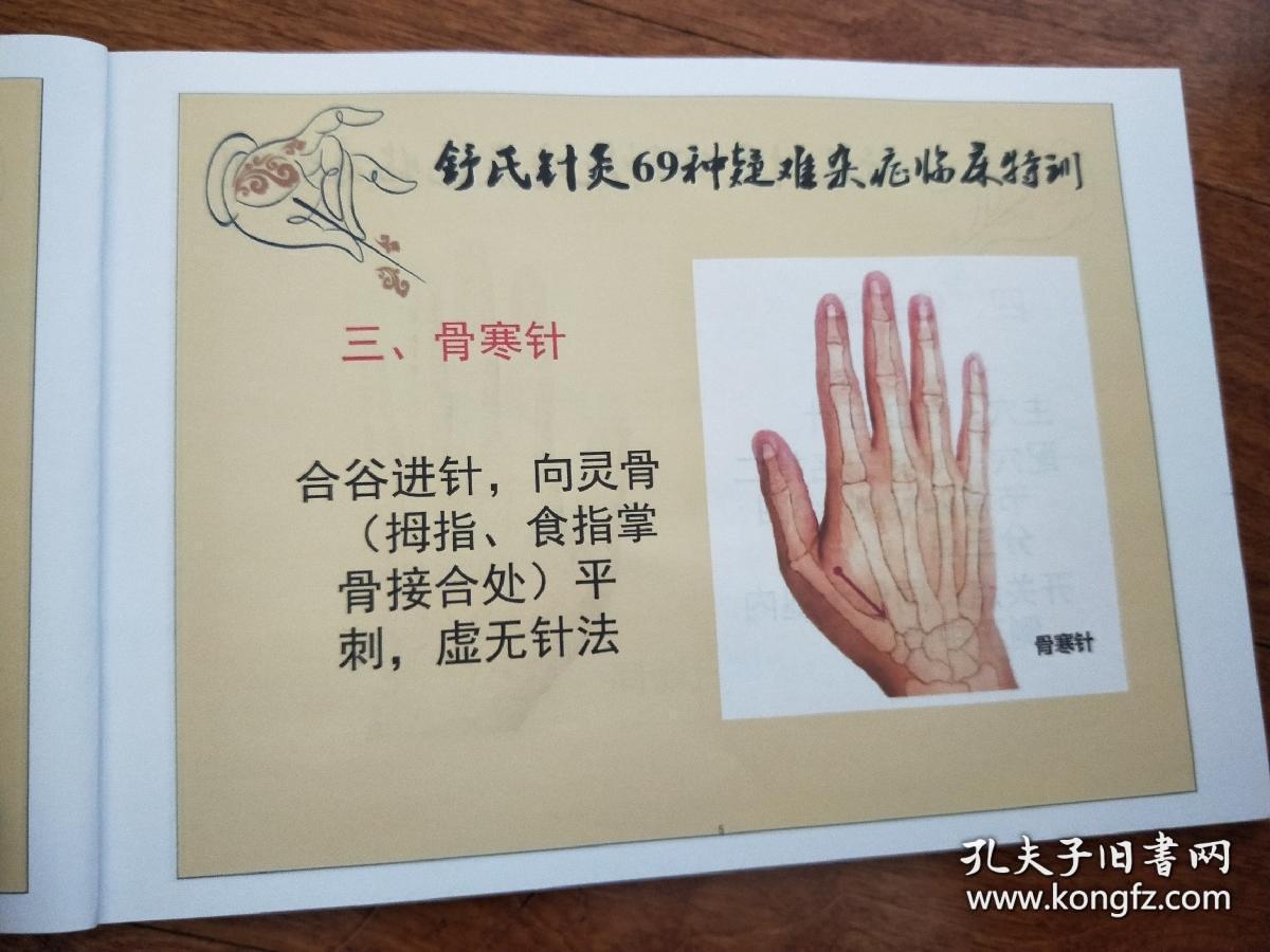 实拍图《新品舒氏针灸69种杂证内部资料》全彩78页实体包邮