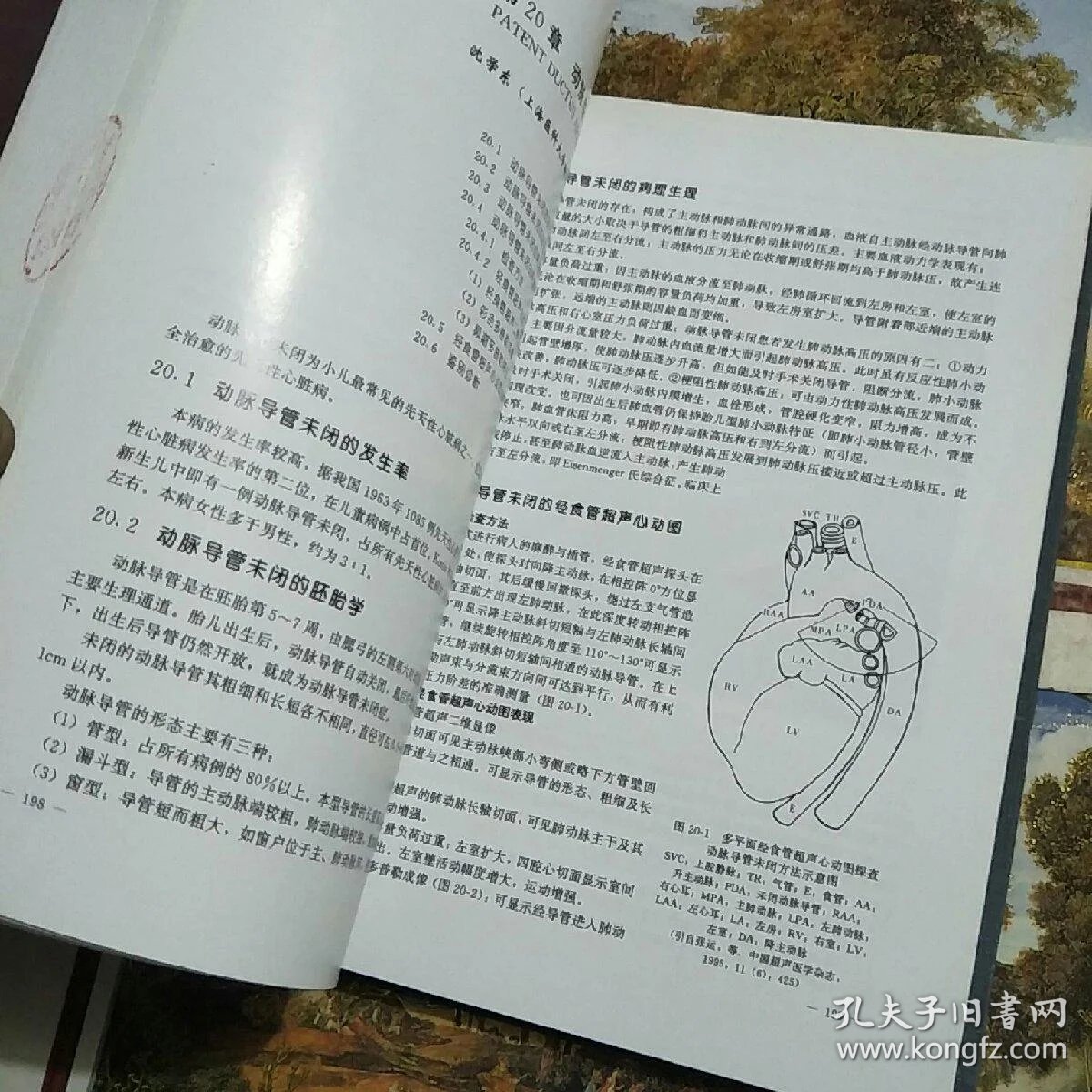 经食管超声心动图学