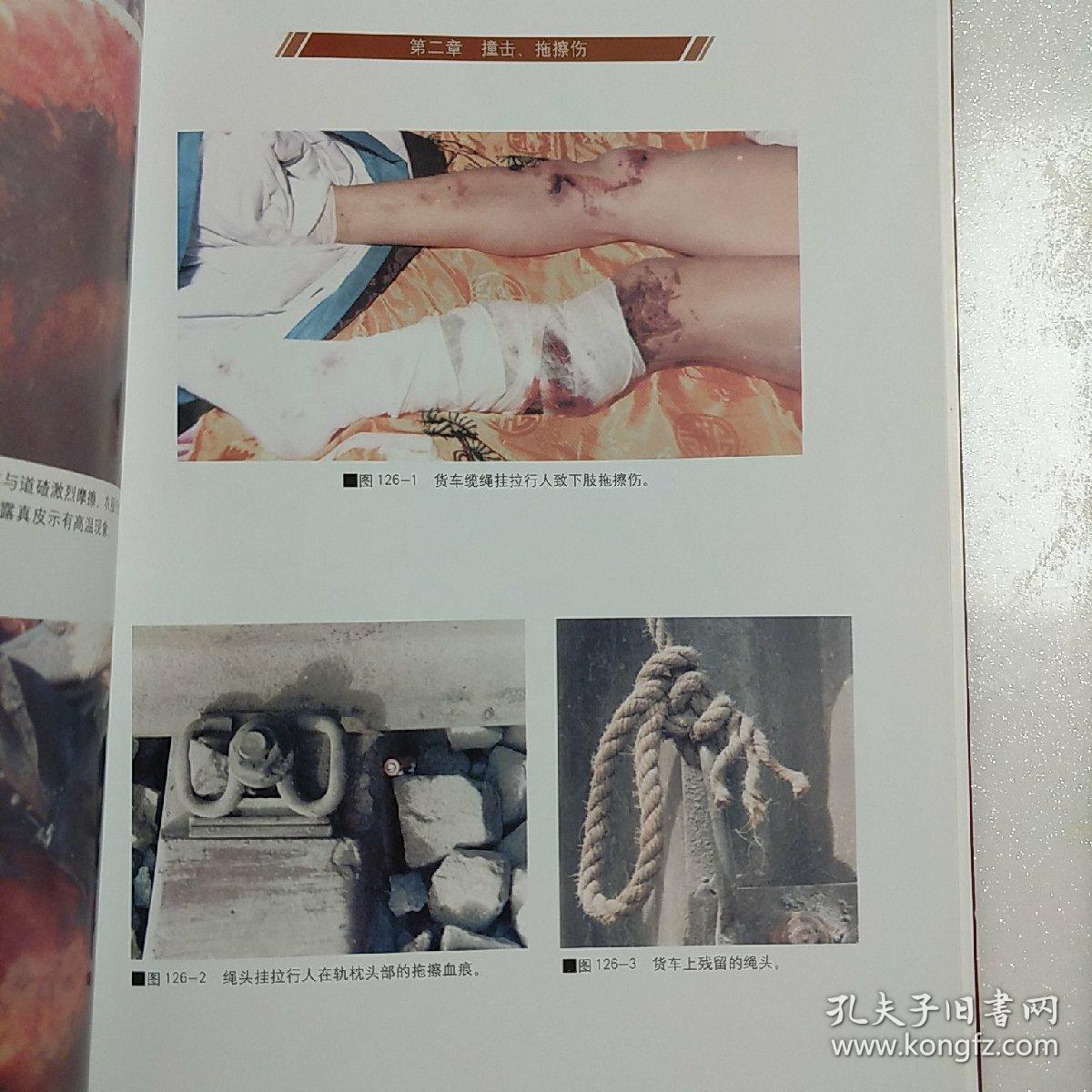 法医学铁道损伤图谱
