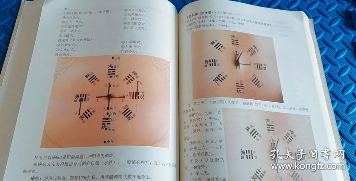 附勘误表,大脐针图彩色说明书,包括观脐诊病,八卦在脐针治疗原理及