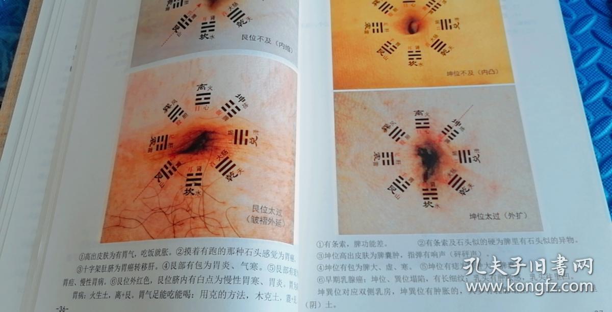 73米大,前后双面覆膜,吴智园(原版,大脐针图彩色说明书,包括观脐诊