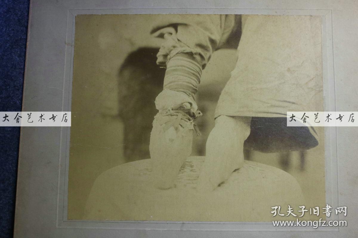 这位女士把自己裸露而畸形的足部展现给摄影师拍照,在百清朝最美小脚