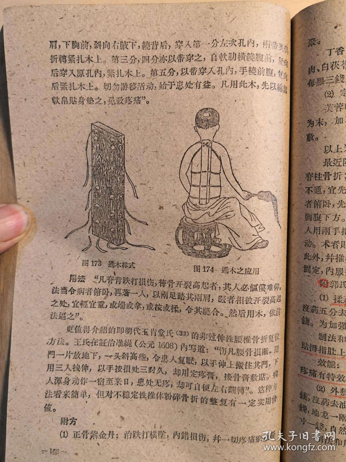 附骨什么疸成语_成语故事图片(3)