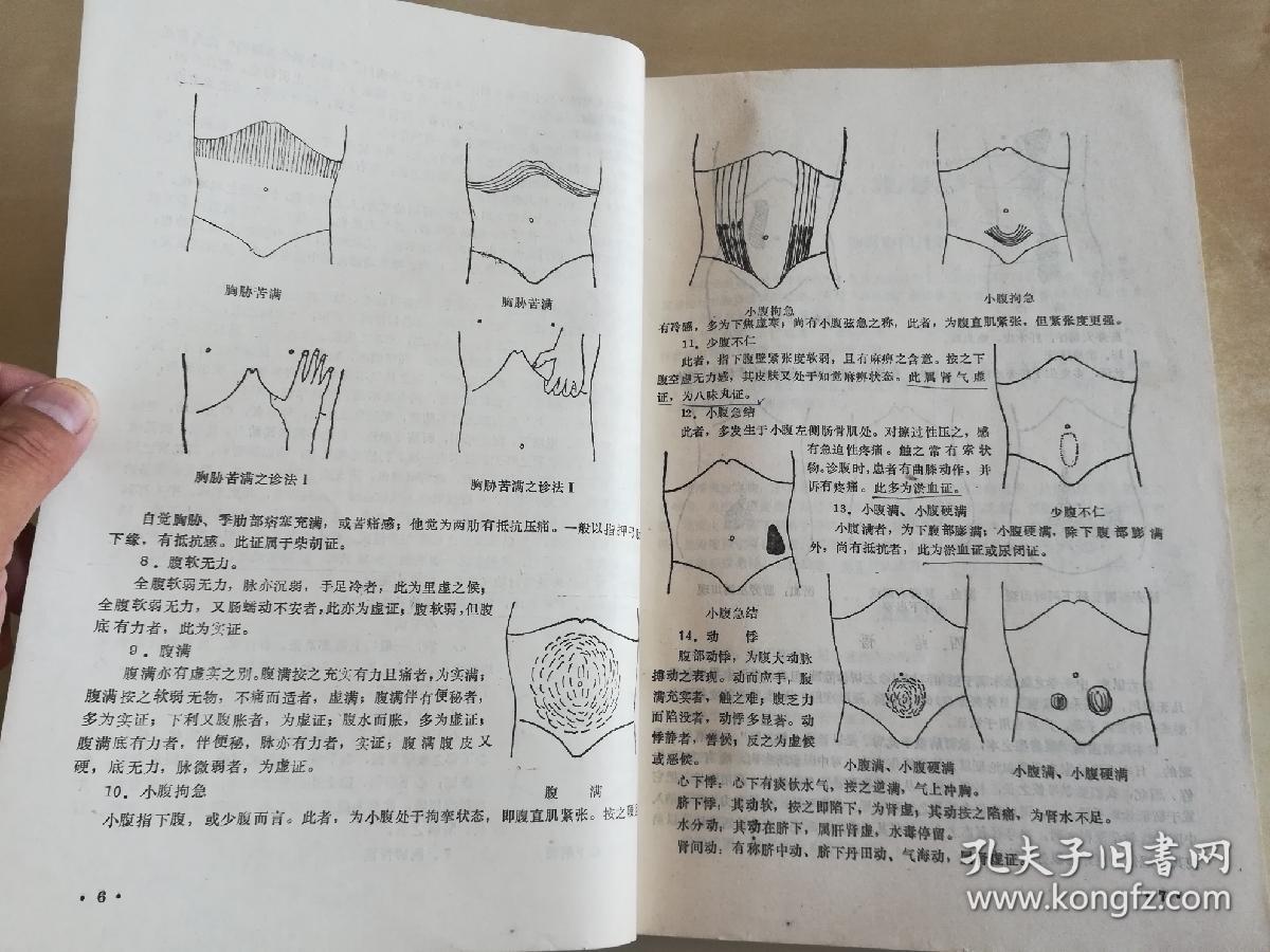 日本汉方腹诊选编