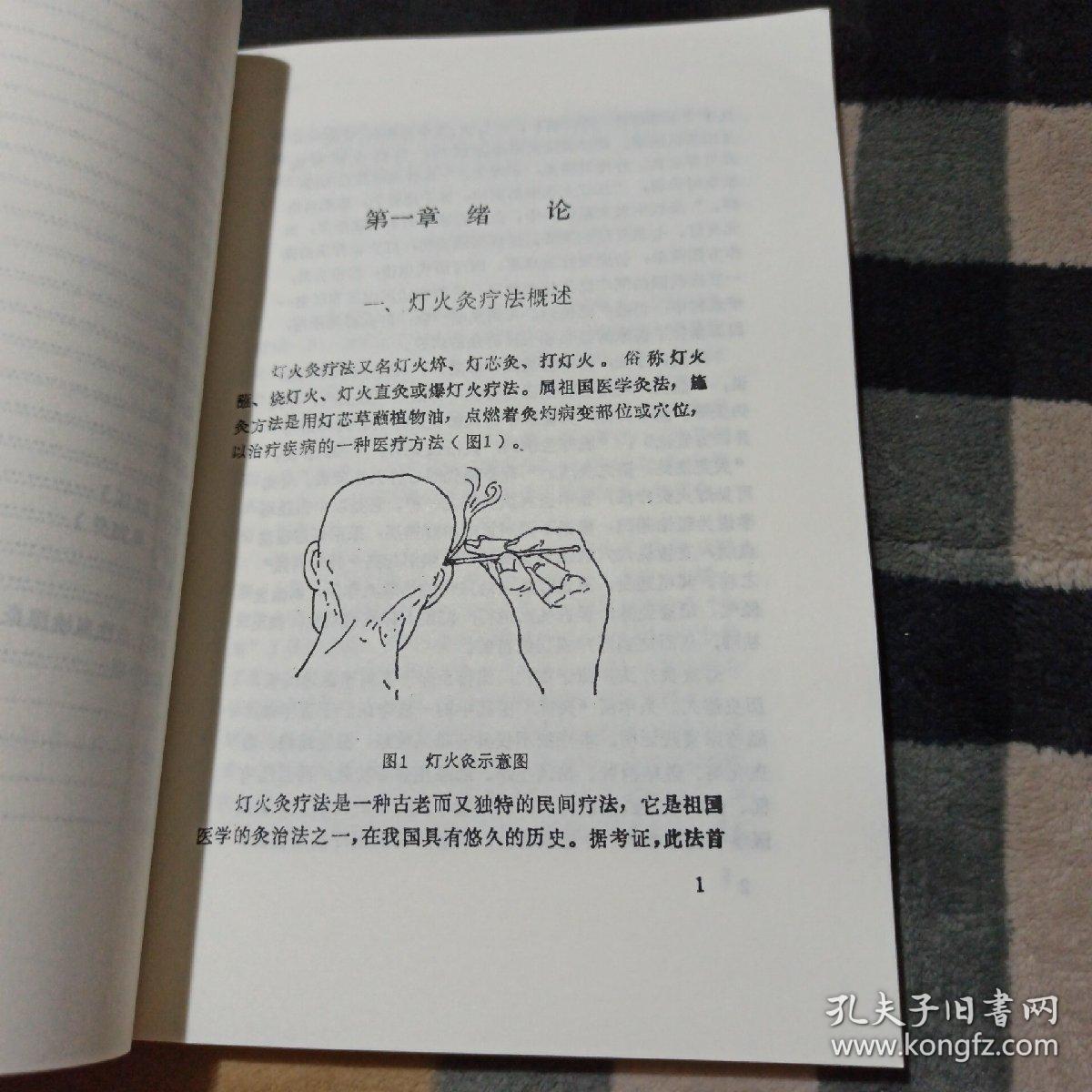 中国民间灯火灸疗法 (影印版)