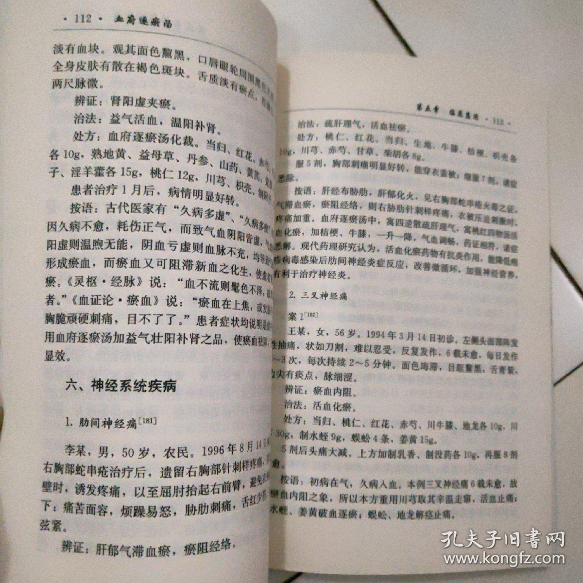 血府逐瘀汤—难病奇方系列丛书