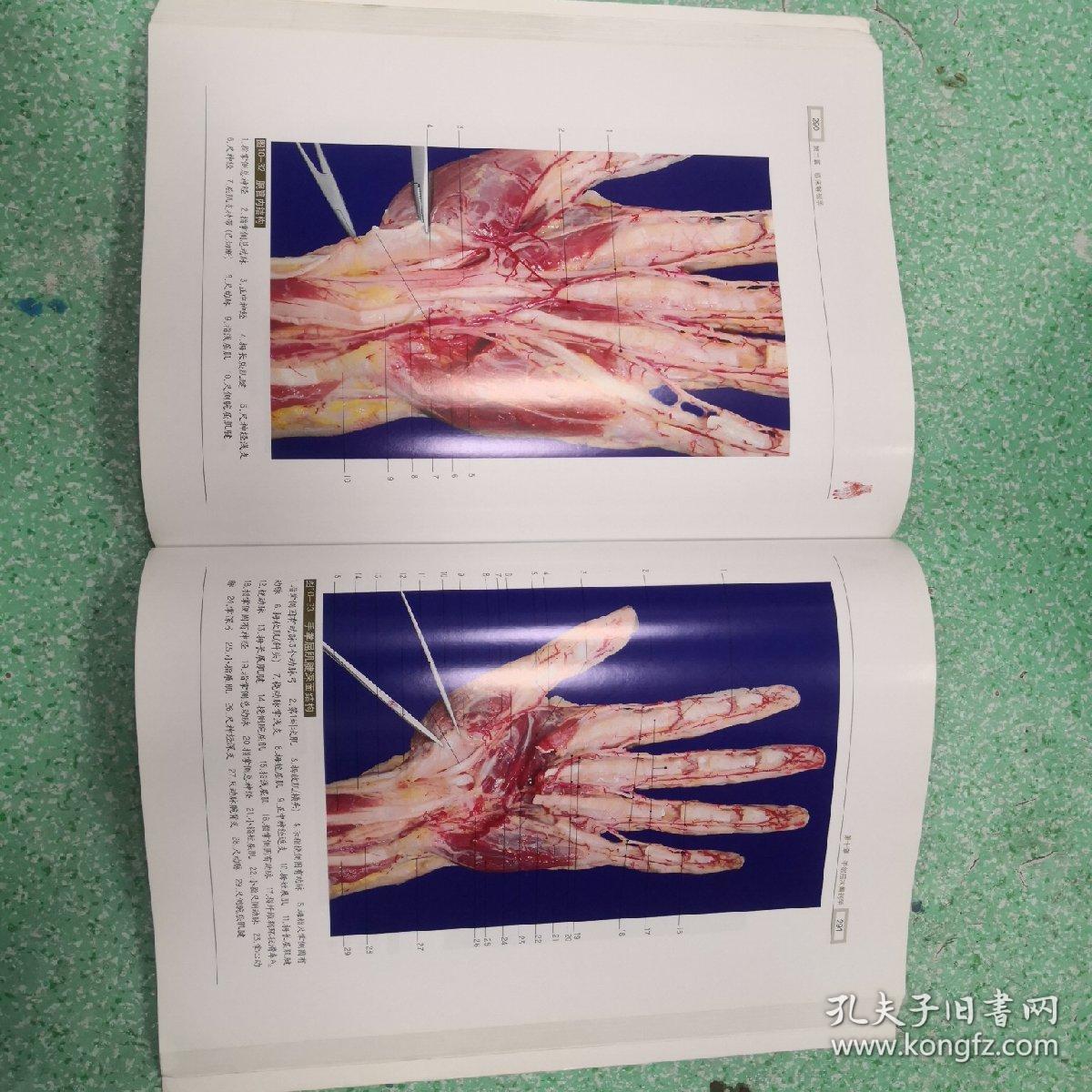 手外科解剖学图鉴书脊有伤看图,,_丁自海,王增涛 著_孔夫子旧书网