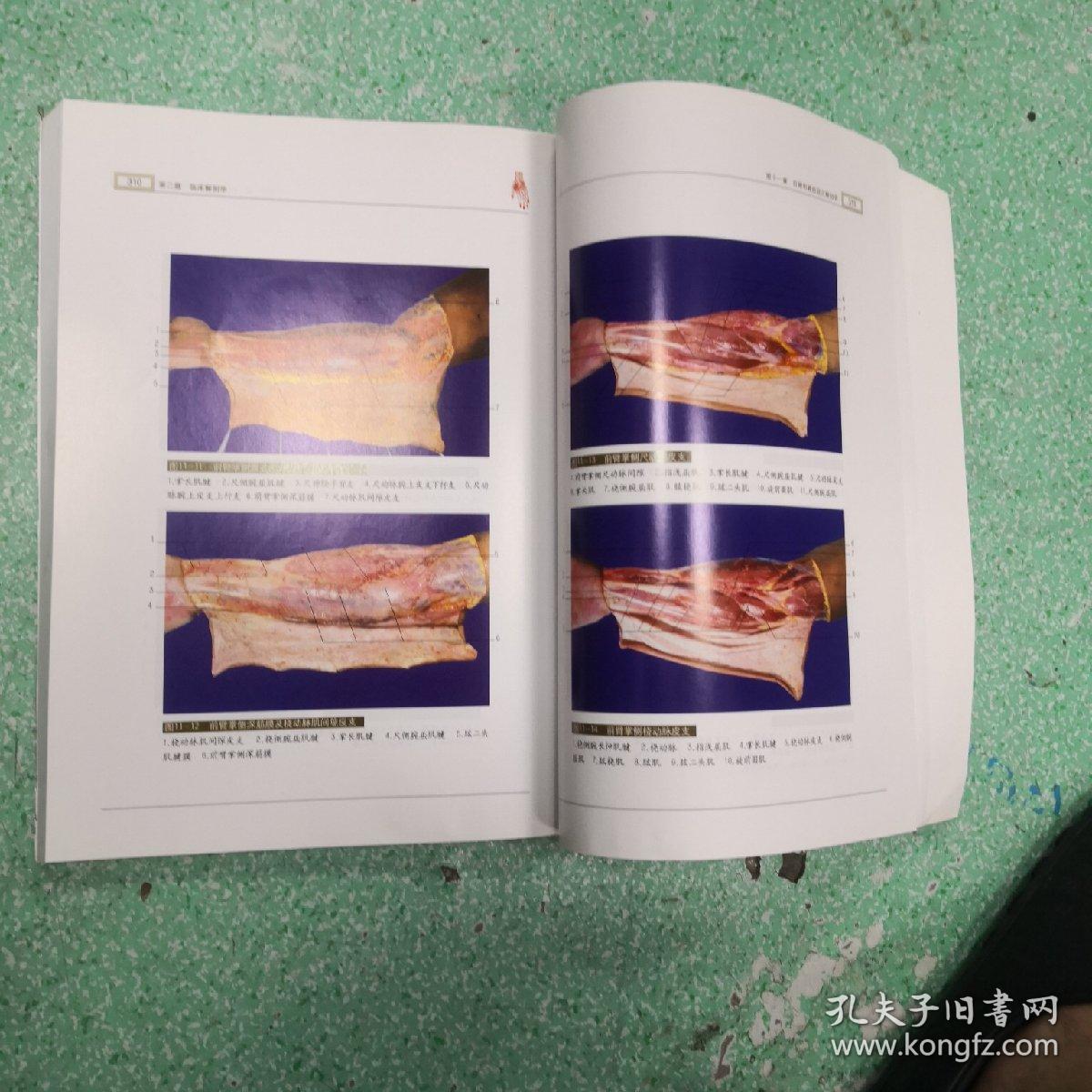 手外科解剖学图鉴书脊有伤看图,_丁自海,王增涛 著_孔夫子旧书网
