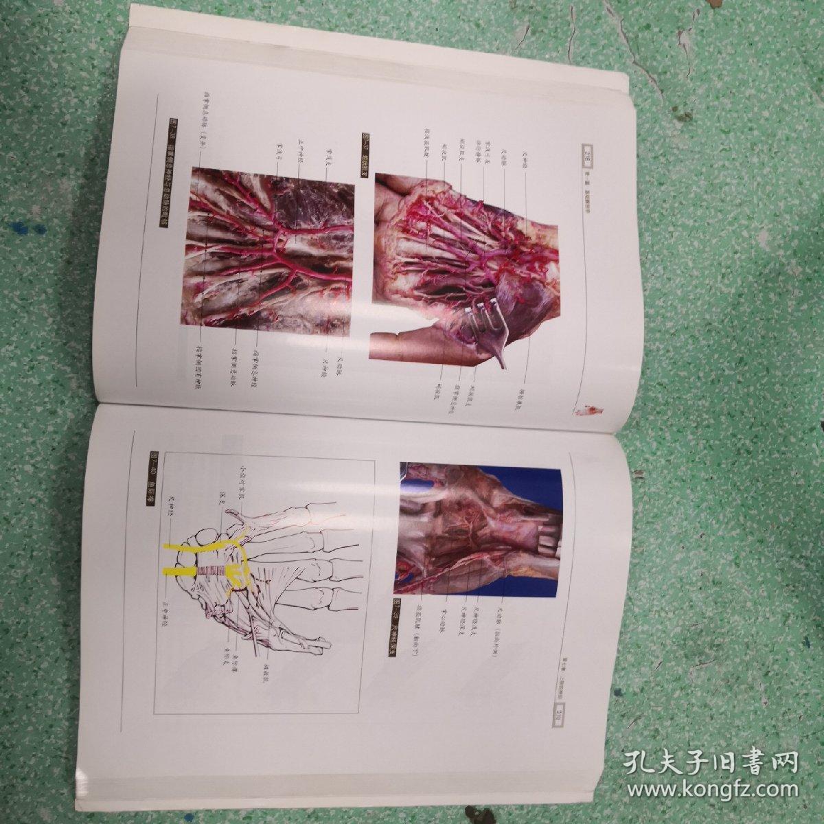 手外科解剖学图鉴书脊有伤看图,,_丁自海,王增涛 著_孔夫子旧书网