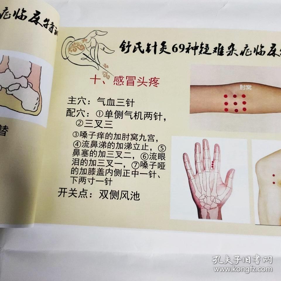 舒氏针灸69种杂证