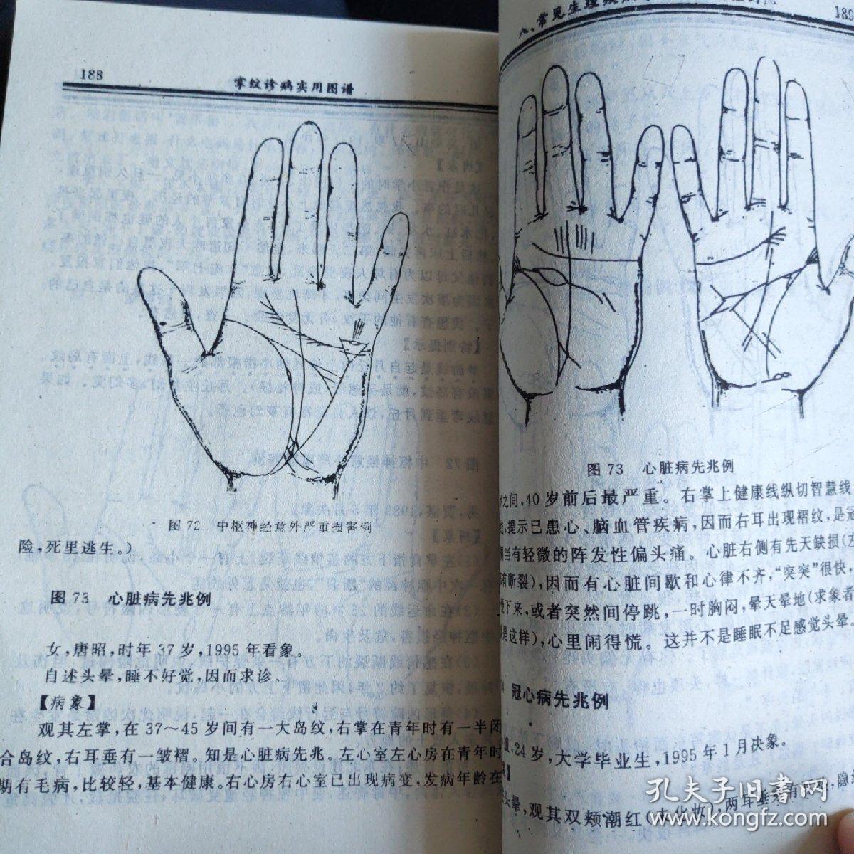 简谱掌纹_曹格掌纹简谱(3)