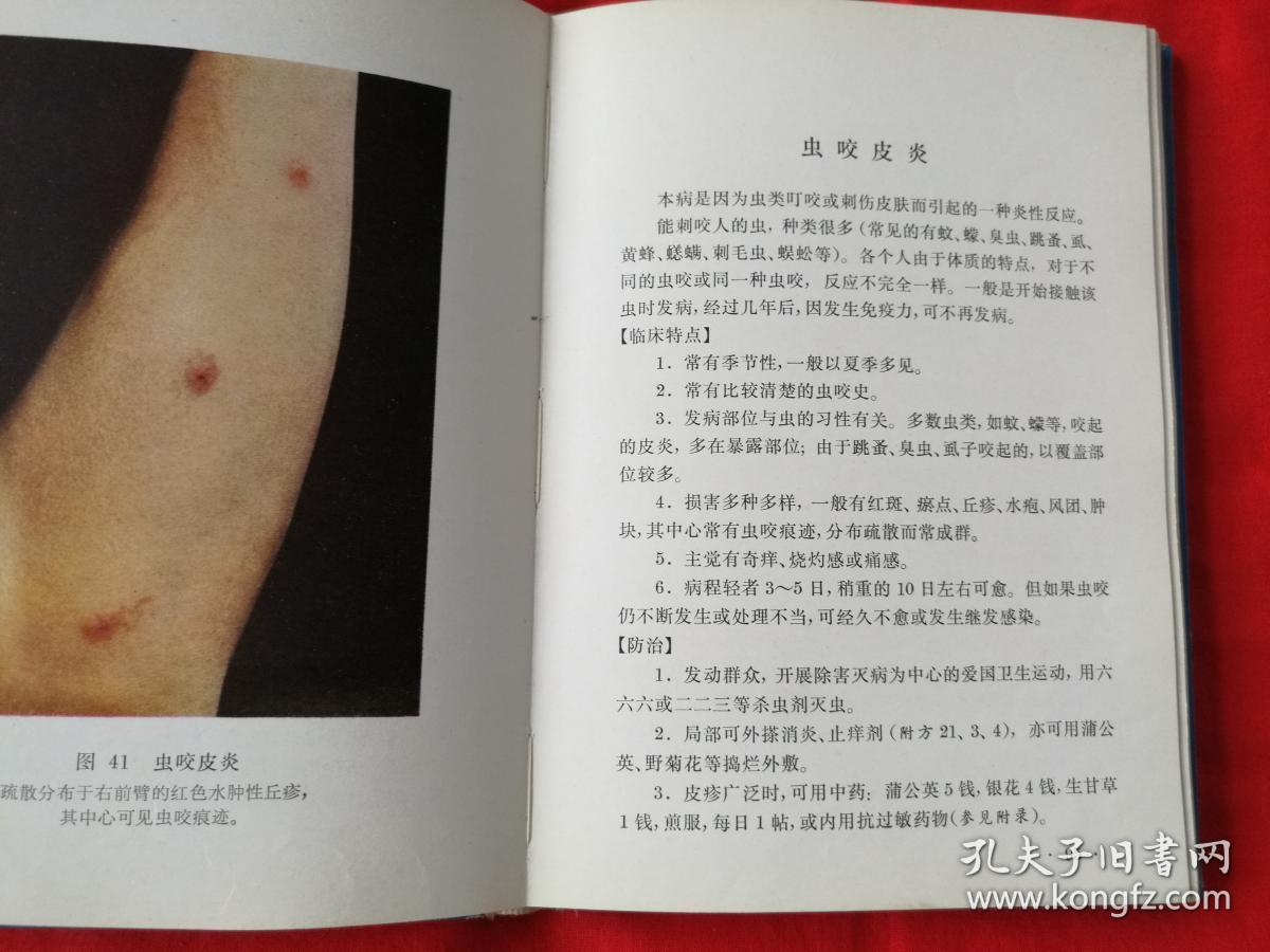 常见皮肤病图谱(精装本彩图版,内部发行.有中药药方)馆藏本.