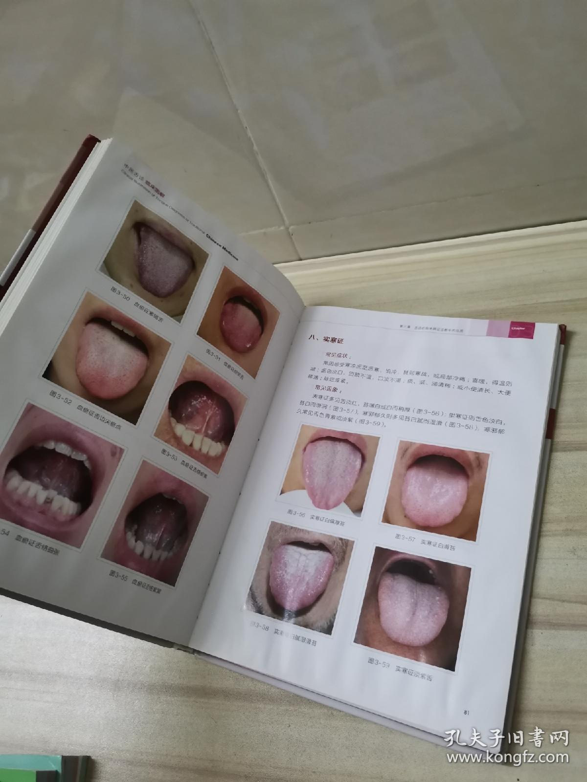 中医舌诊临床图解