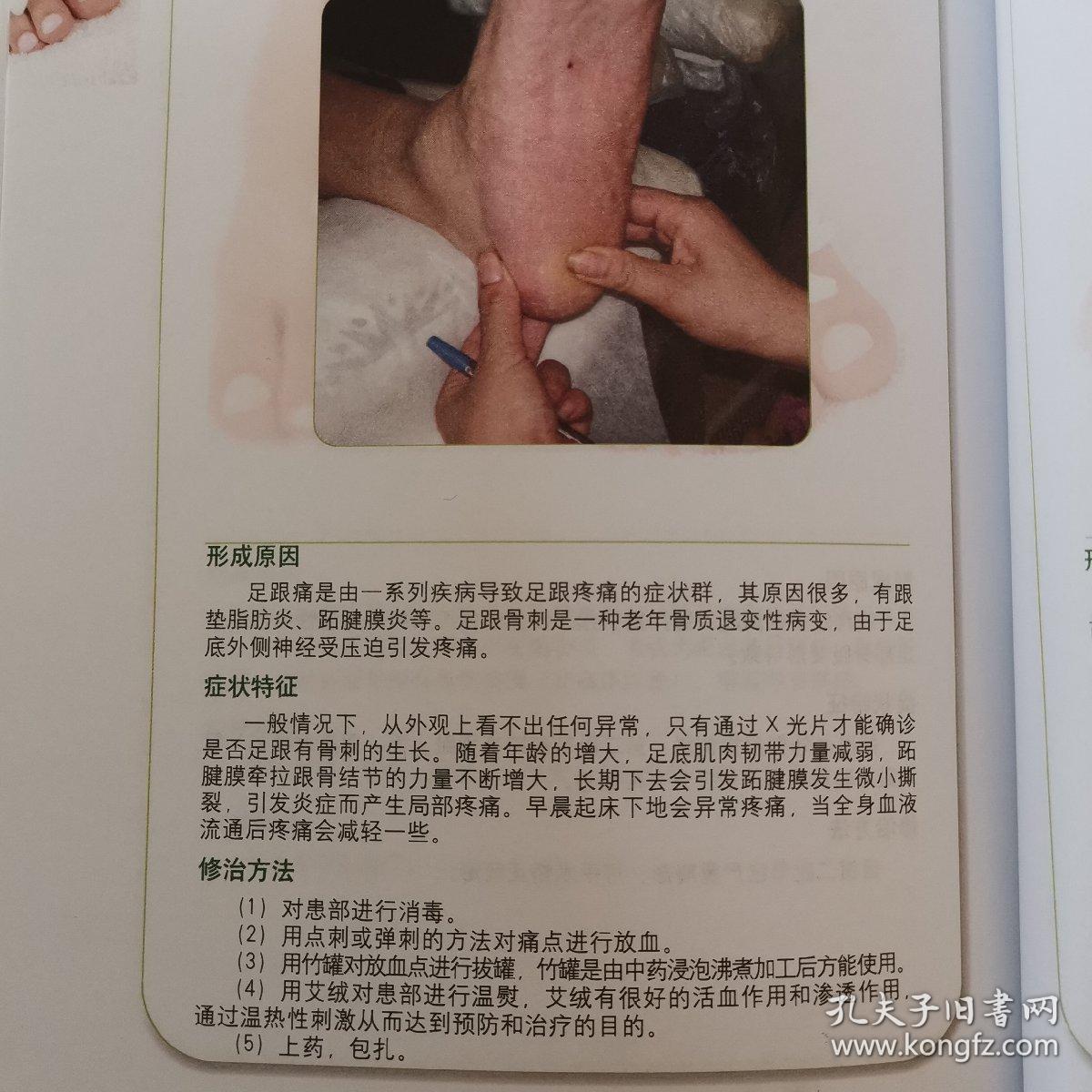 修脚图谱
