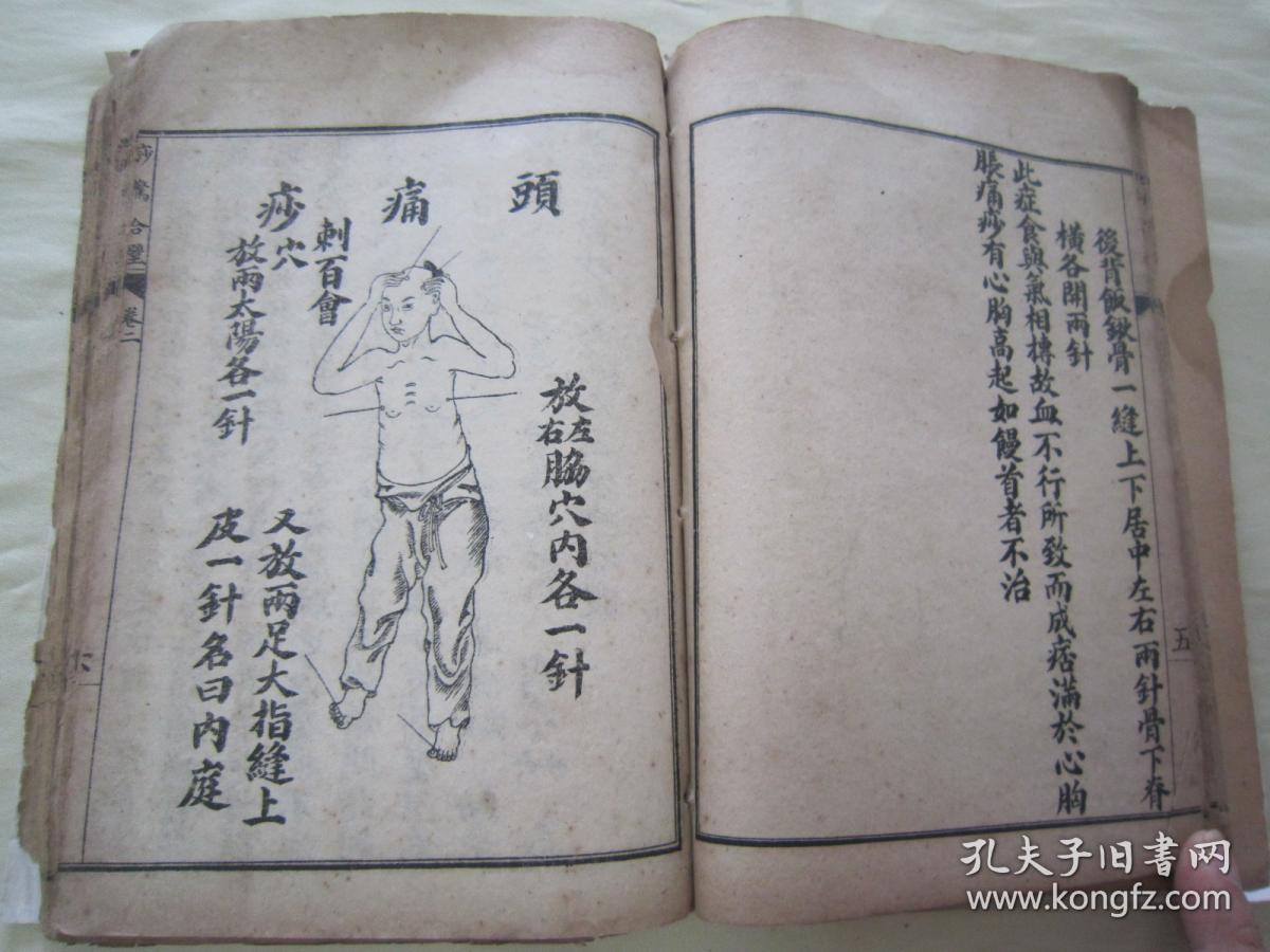 稀见民国老版线装石印"医学名典《绘图痧惊合璧,全四卷,32开线装四