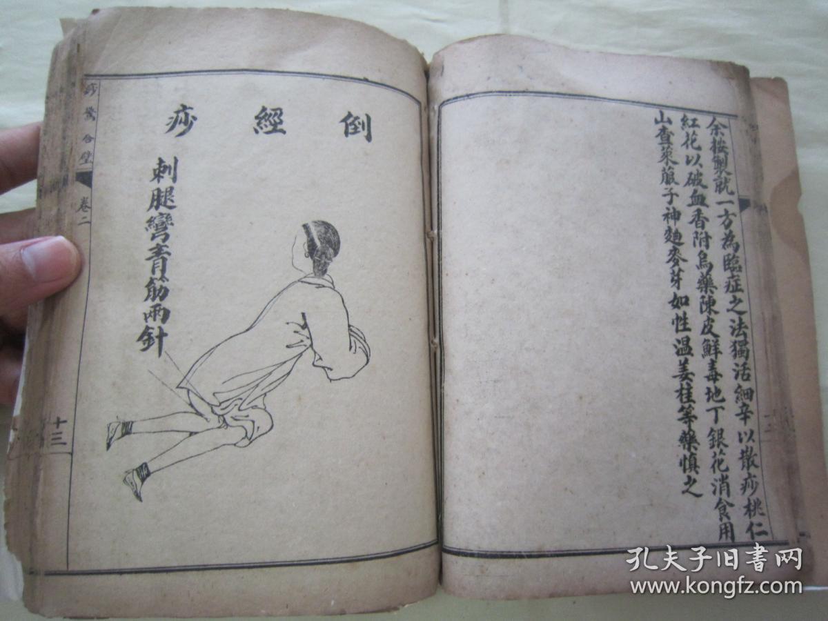 稀见民国老版线装石印"医学名典《绘图痧惊合璧,全四卷,32开线装四