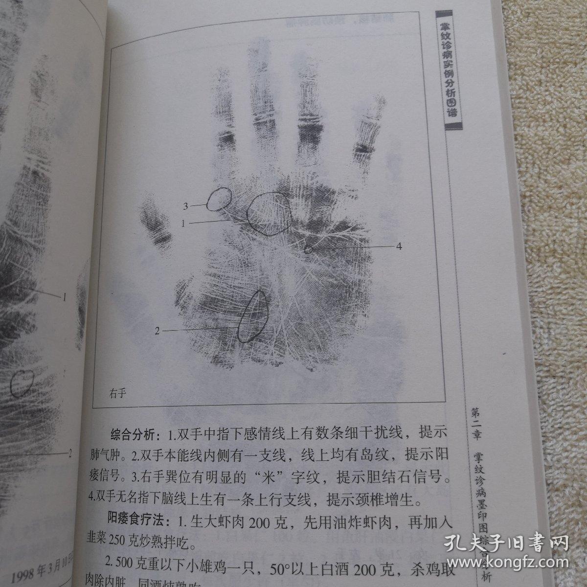 掌纹诊病实例分析图谱