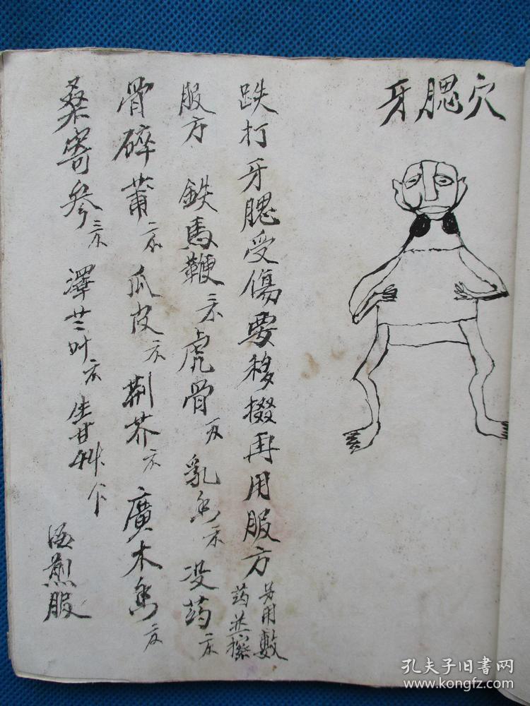 【复印件】跌打损伤秘方照穴用药1 中医古籍古书老医书手抄本医书复印