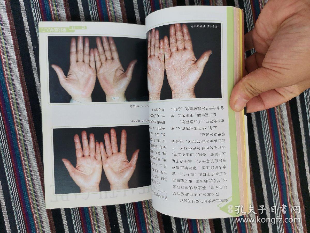 掌纹医学入门_王晨霞_孔夫子旧书网