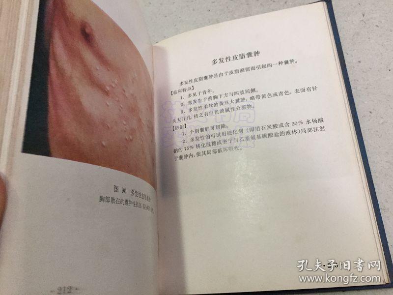 常见皮肤病图谱