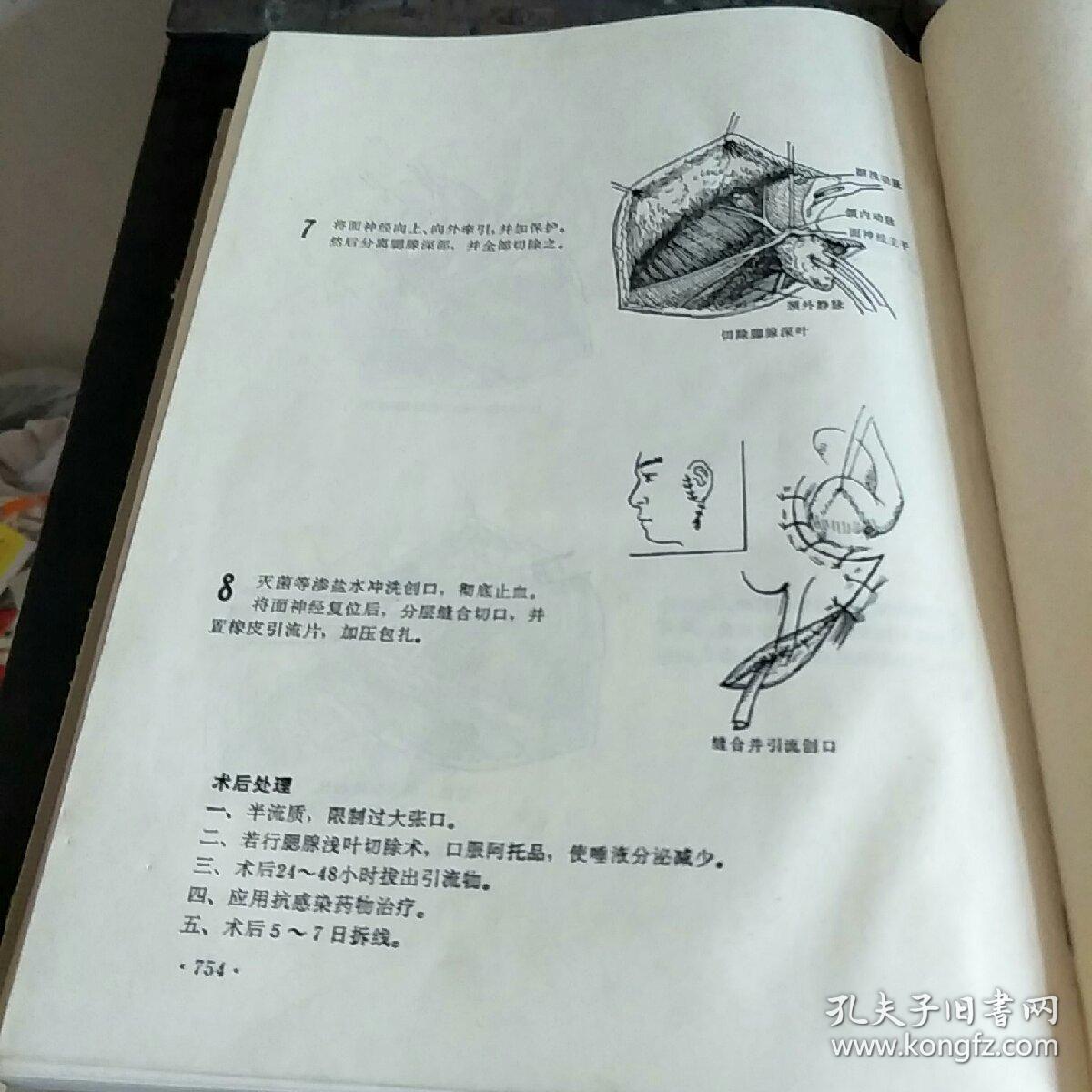 手术图解