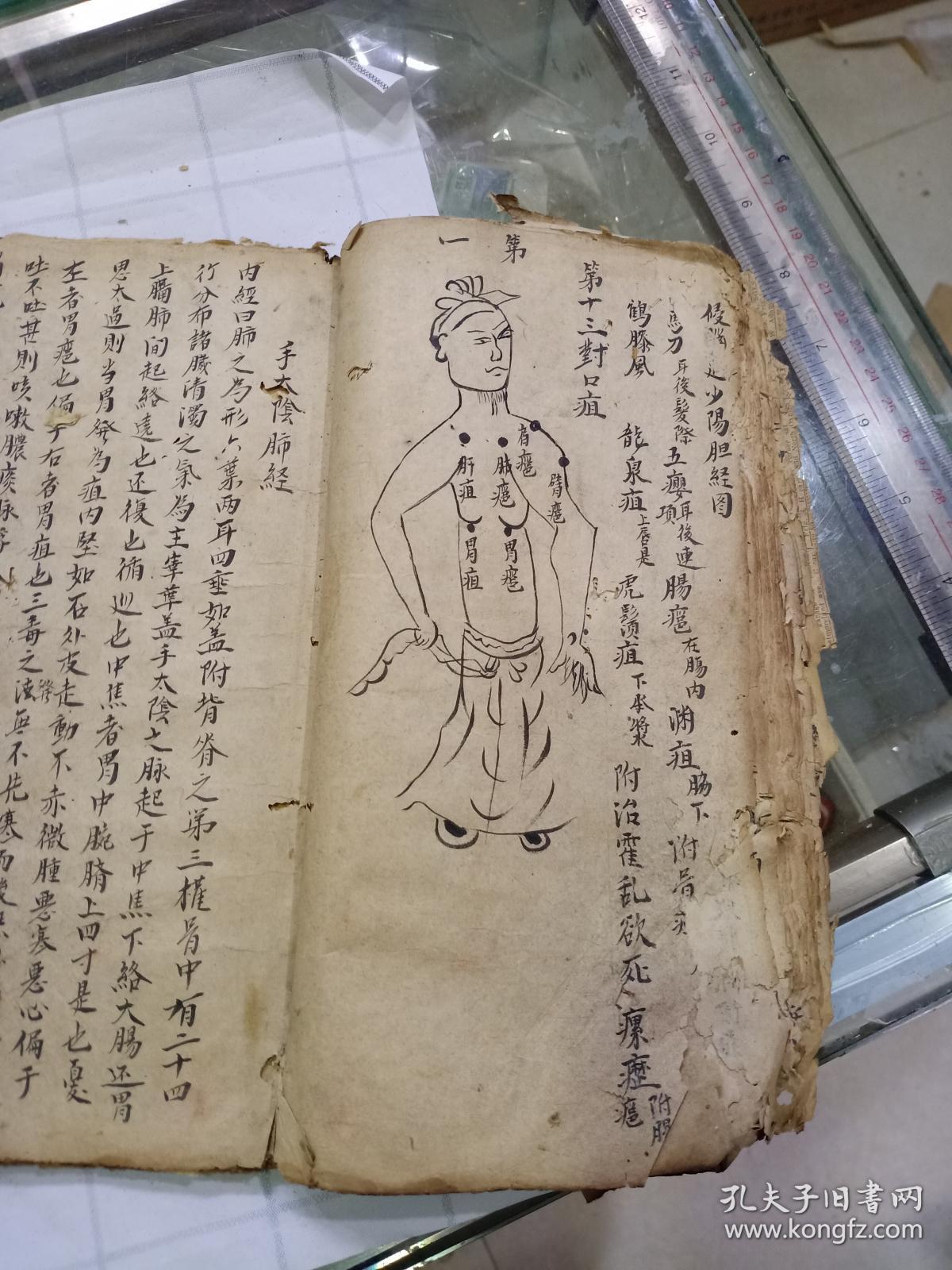 祖传针灸短剧，传承与现代融合的医疗艺术
