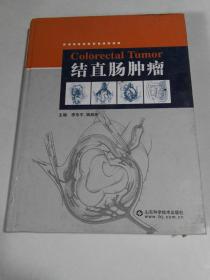 结直肠肿瘤
