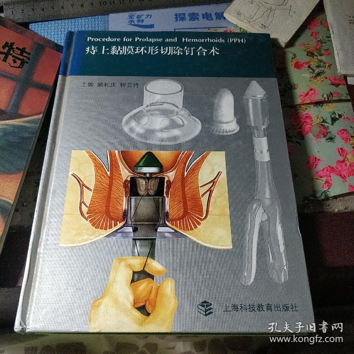 痔上黏膜环形切除钉合术