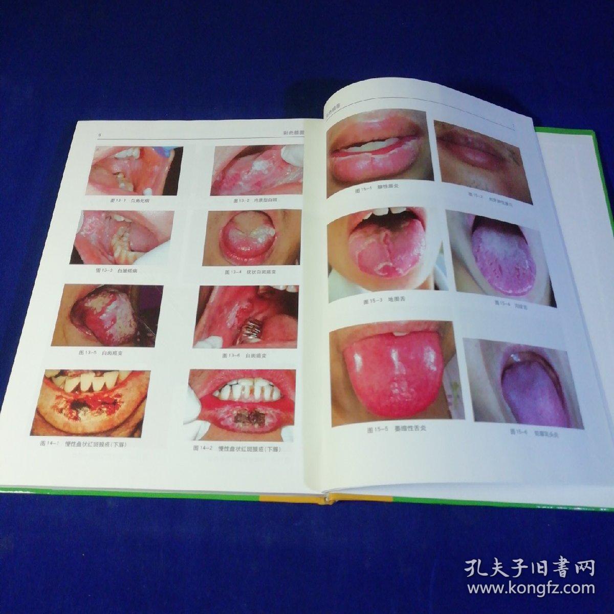 李秉琦实用口腔黏膜病学【精装】