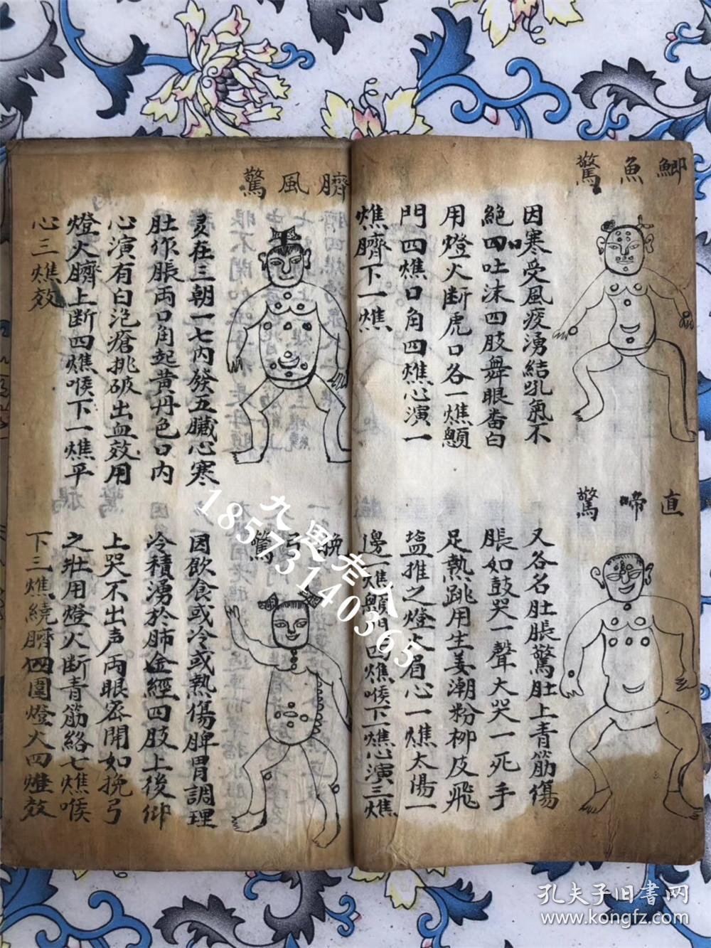 【复印件】道医绝学,传世秘方,带图解说【药王咒病法】【小儿平常诸症