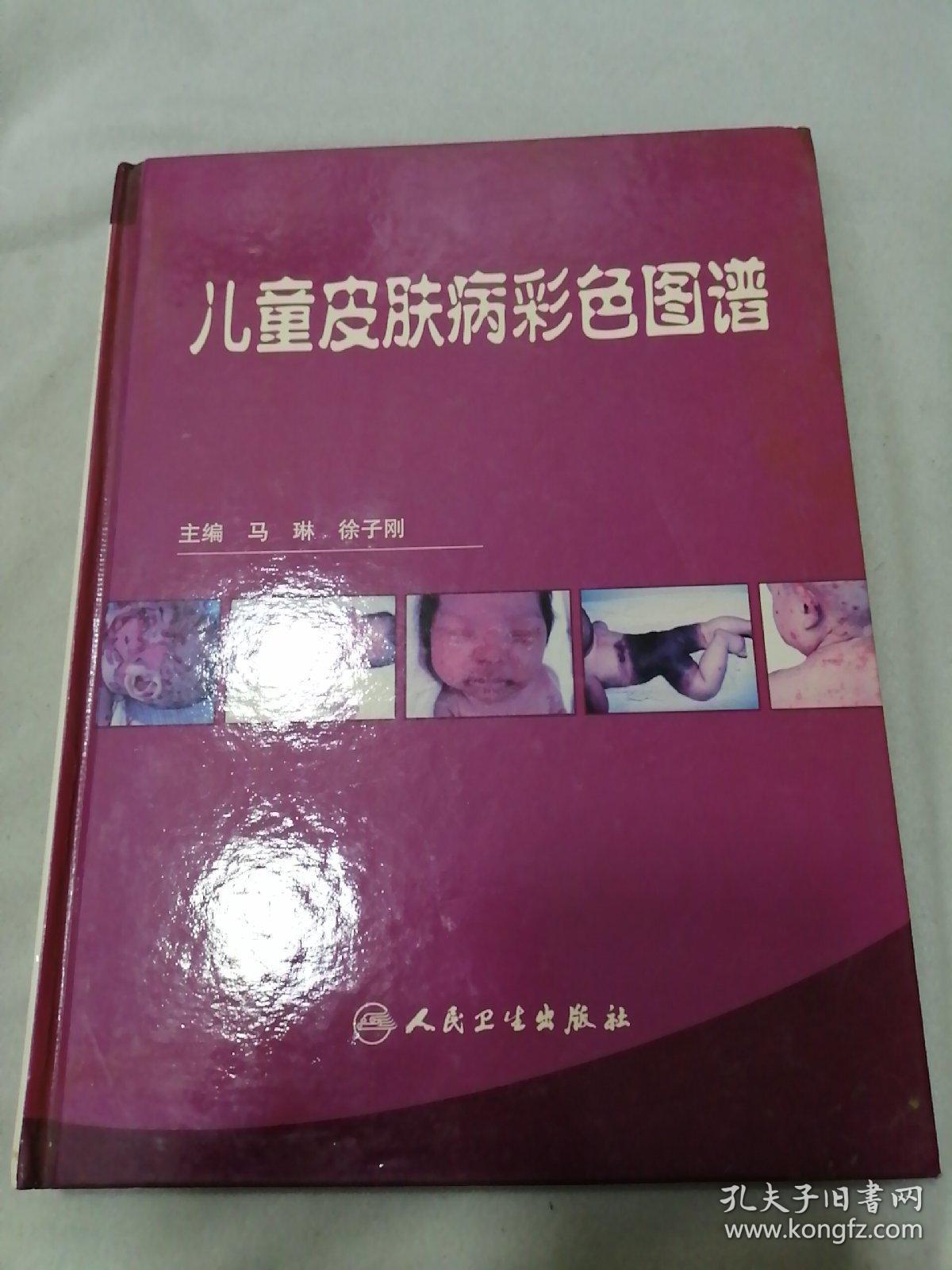 儿童皮肤病彩色图谱