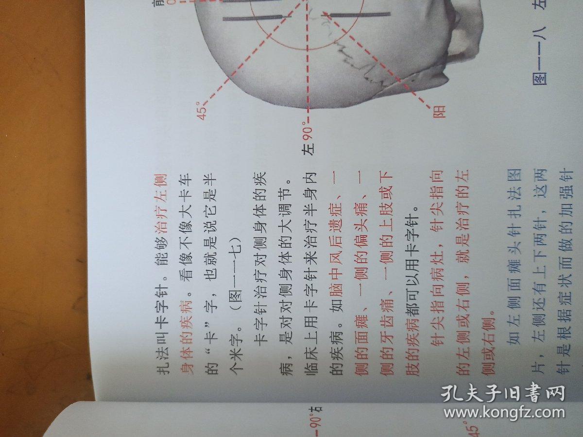 唐氏靶向定位针法