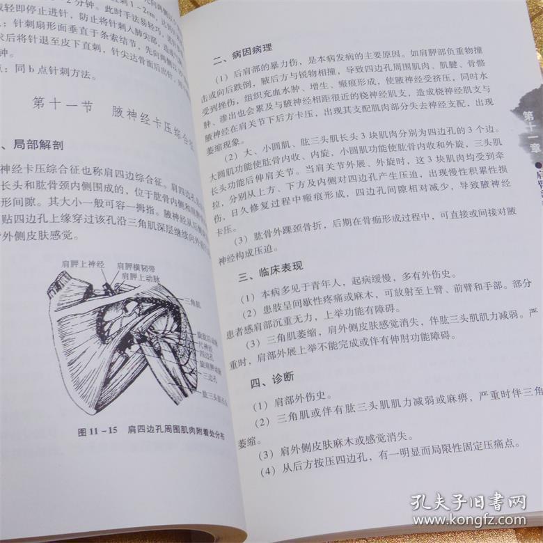 圆利针疗法:运动损伤中西医结合针灸疗法最新版胡超伟