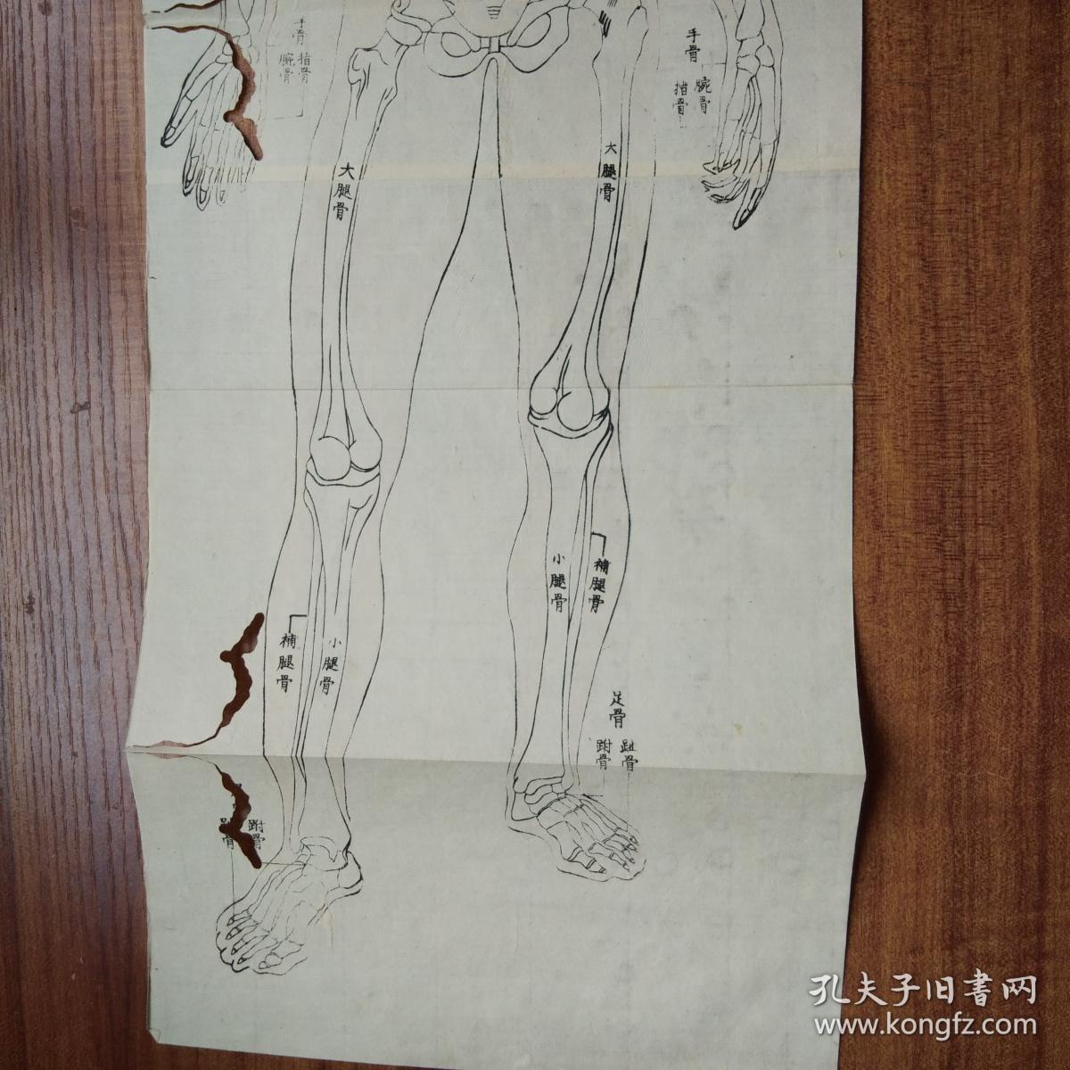 和刻本 【初学人身穷理】2册全 (人体生理解剖) 一幅木版【人体骨骼图