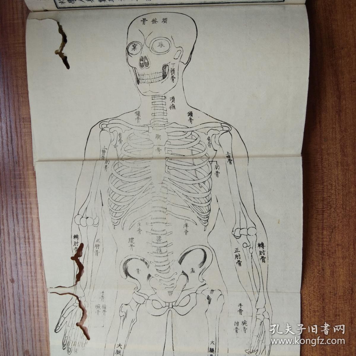 和刻本 【初学人身穷理】2册全 (人体生理解剖) 一幅木版【人体骨骼图