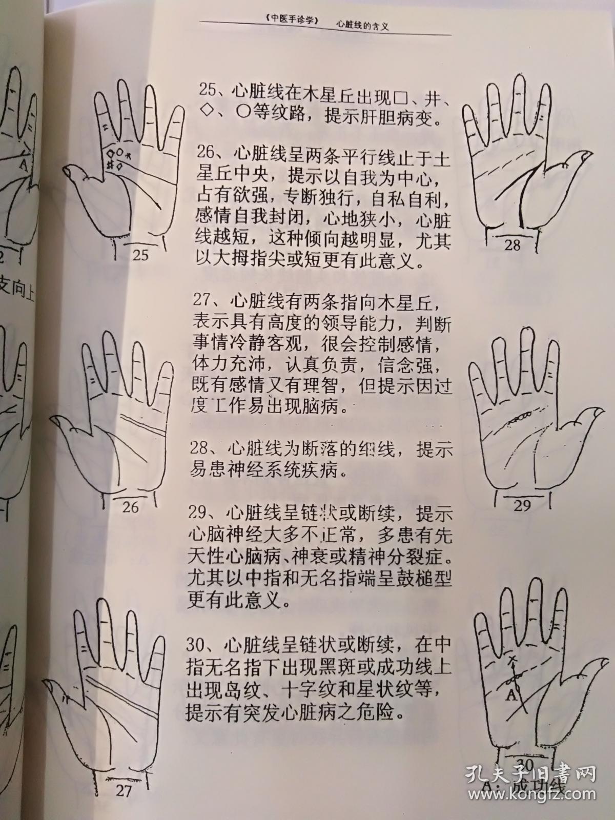 中医手诊学 (影印本)