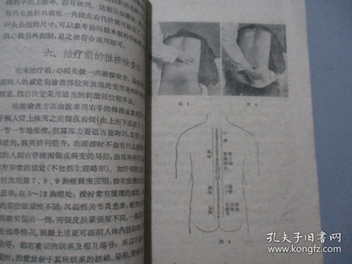 七星针疗法