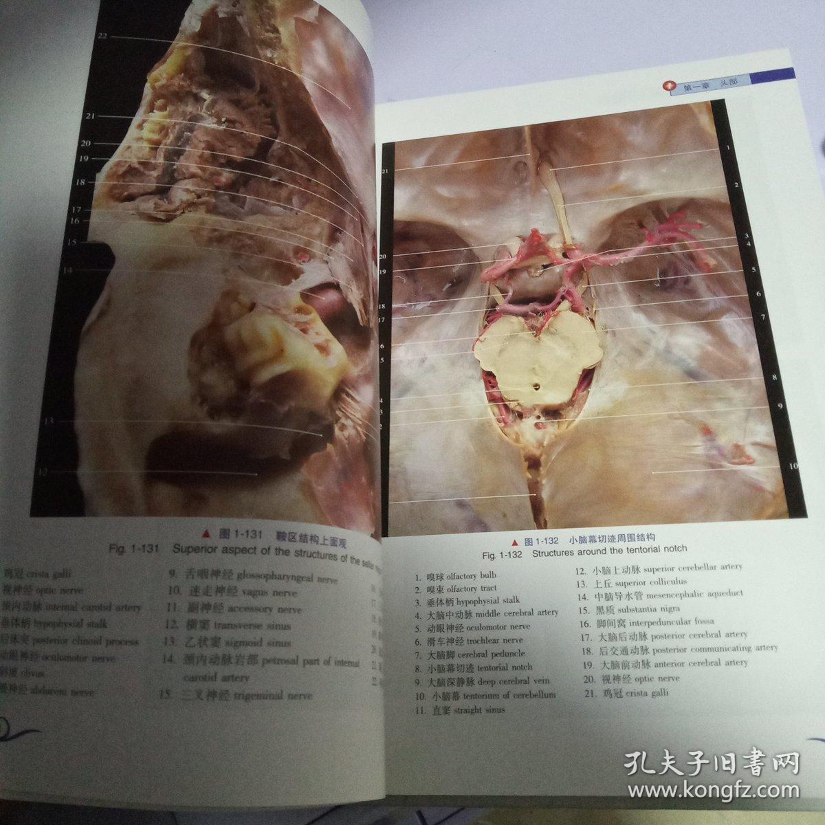 头颈部临床解剖实物图谱(第2版)