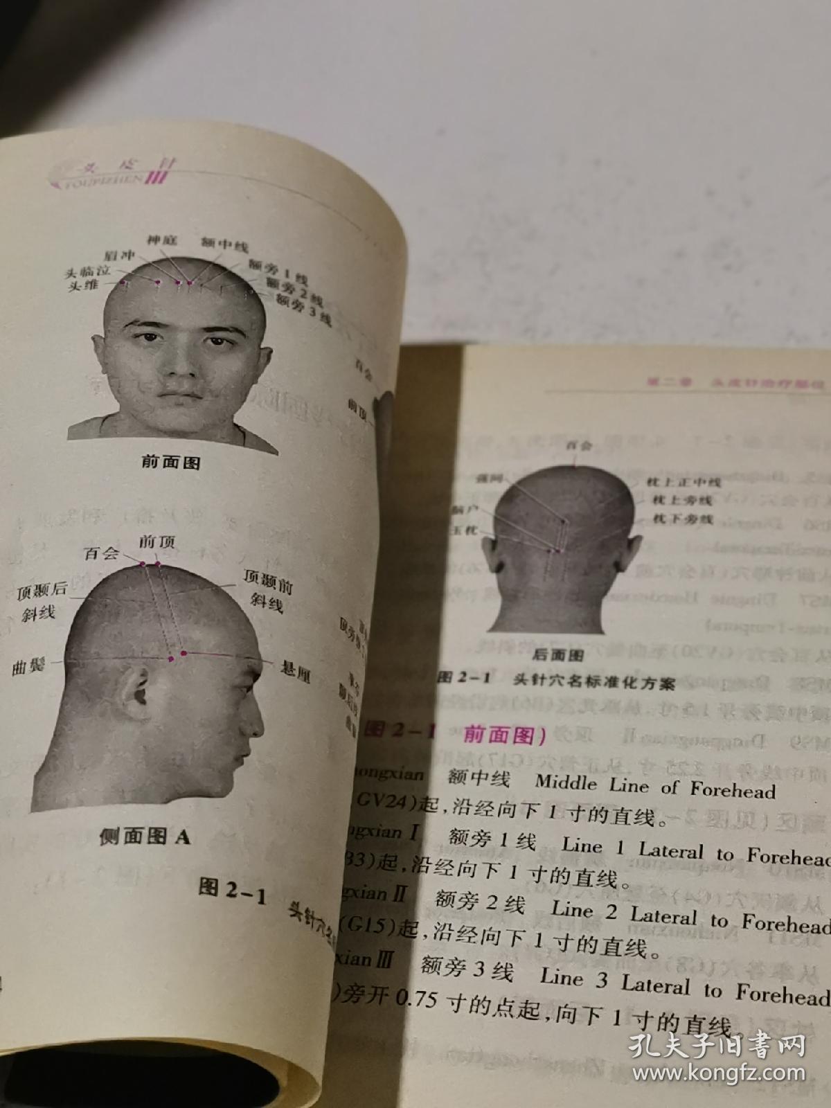 头皮针——中国特种针法丛书(书里有划线笔记)