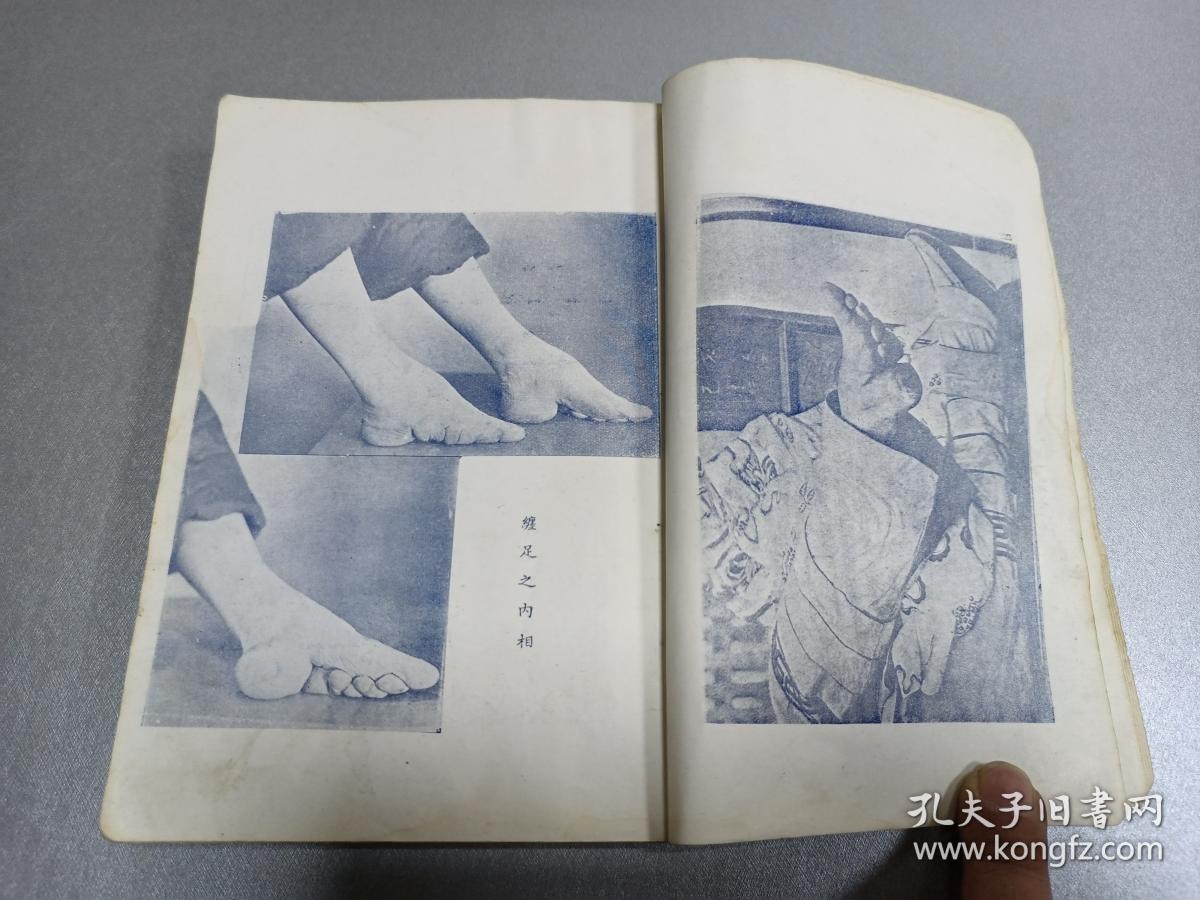 《采菲录》第四编 一厚册全 多彩图 三寸金莲形成的方法 胡应麟论缠足