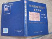 肝胆肿瘤病理学彩色图谱 98年一版一印，印量2000，精装95品