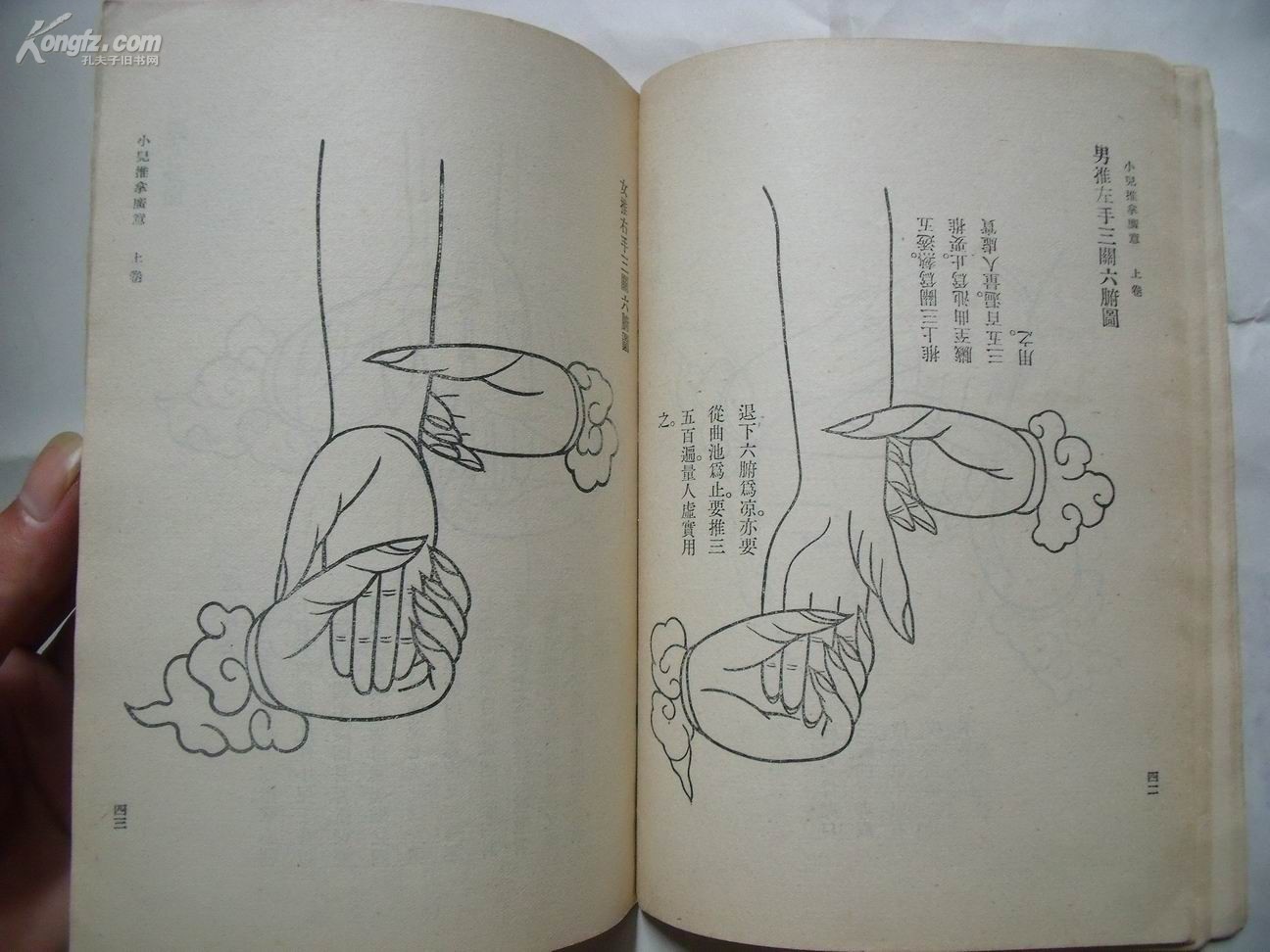 3502《小儿推拿广意》(清 熊应雄 著 馆藏