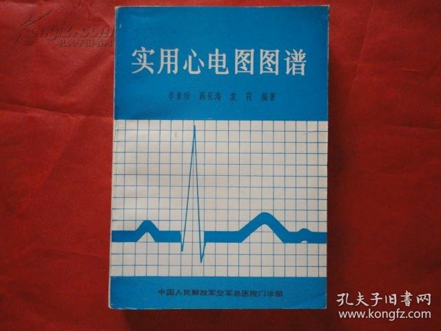 心电图简谱_正常心电图图片(2)