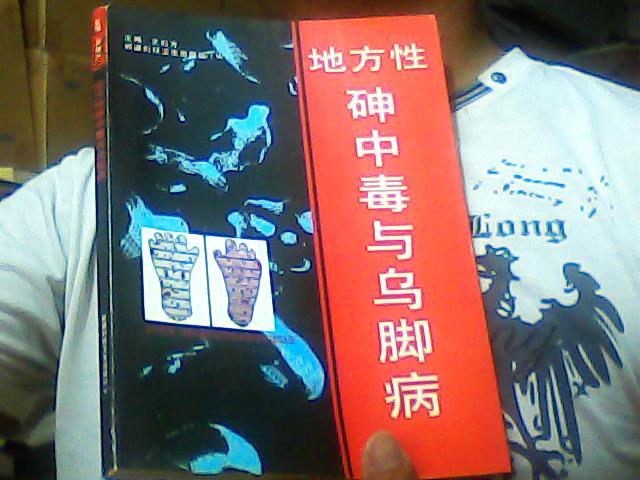 地方性砷中毒与乌脚病