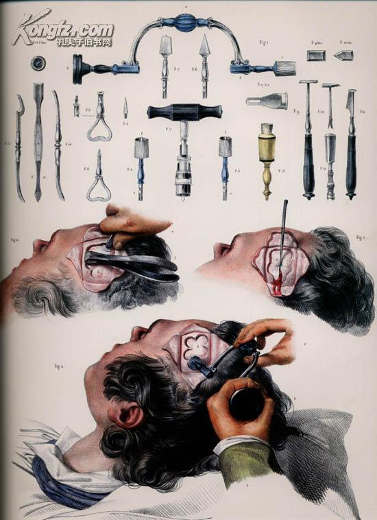 德国塔森版atlas of human anatomy and surgery解剖和手术图谱