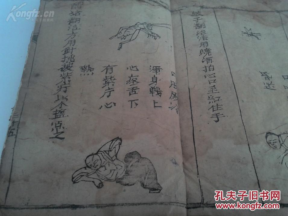 俗称《七十二翻症》,内收一百四十余幅病症版画图,此书记载了七十二种