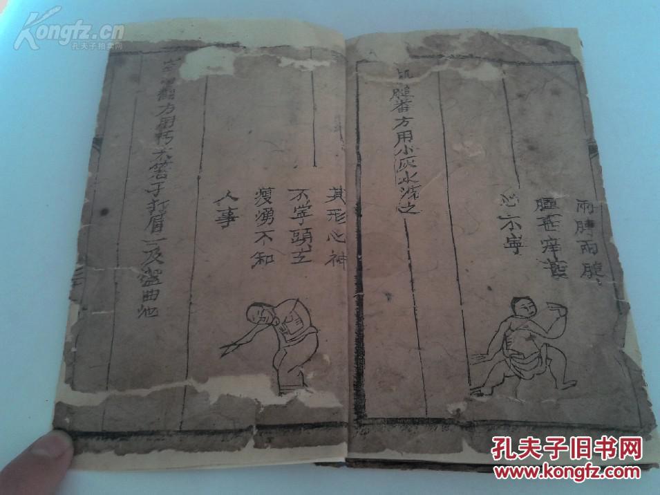 俗称《七十二翻症》,内收一百四十余幅病症版画图,此书记载了七十二种
